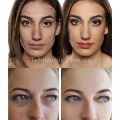 Набор Medica+ 2в1: Очиститель кожи и пор вакуумный ScinClean 7.0 + Инструменты для чистки лица EasyClean