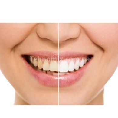 Насадки для ультразвуковой зубной щетки Medica+ ProBrush 9.0 Ultrasonic набор 8 штук (Япония) Черные 501123
