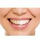 Насадки для ультразвуковой зубной щетки Medica+ ProBrush 9.0 Ultrasonic набор 8 штук (Япония) Черные 501123