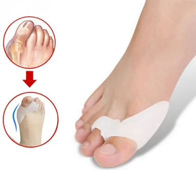 Корректор большого пальца ноги Bunion Bone Ectropion