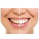 Ультразвукова зубна щітка Medica+ ProBrush 9.0 (Японія) Фуксія 50108