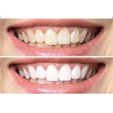 Набір Medica+ 2в1:Ультразвукова зубна щітка Medica+ ProBrush 9.0 Ultrasonic (Японія) Чорна+Біла 50147