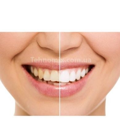 Ультразвукова зубна щітка Medica+ ProBrush 9.0 Ultrasonic + насадки (10 штук) (Японія) Фуксія 50188