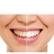 Ультразвукова зубна щітка Medica+ ProBrush 9.0 Ultrasonic + насадки (10 штук) (Японія) Фуксія 50188