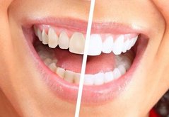 Отбеливатель зубов White Light Tooth
