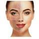 Очисник шкіри та пор вакуумний Medica+ Skincleaner 7.0 (Японія) 50116