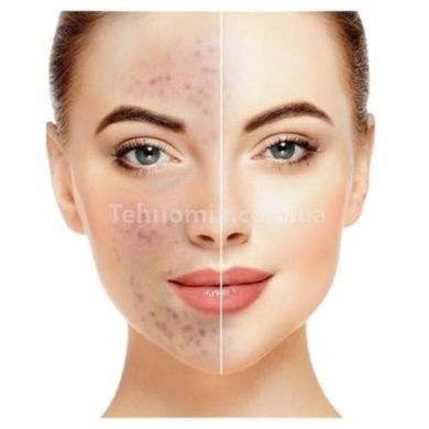 Скрабер Ультразвуковой для кожи лица Medica+ Vibroskin 5.0 (Япония) 50122
