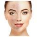 Скрабер Ультразвуковой для кожи лица Medica+ Vibroskin 5.0 (Япония) 50122
