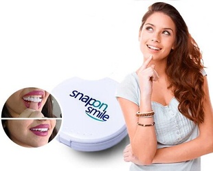 Съемная винира для зубов Snap On Smile с кейсом